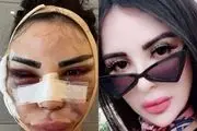 نابودی جوان مردم بخاطر علاقه به سلبریتی معروف!+عکس