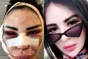 نابودی جوان مردم بخاطر علاقه به سلبریتی معروف!+عکس
