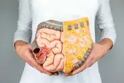 ۶ خوراکی بدنام که در واقع دوست روده هستند!
