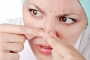 تکنیک های برای نابودی آکنه بینی