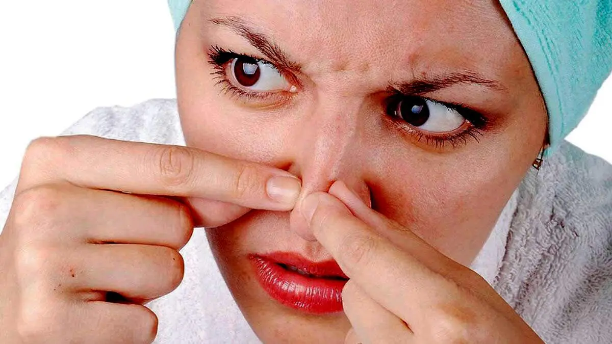 تکنیک های برای نابودی آکنه بینی