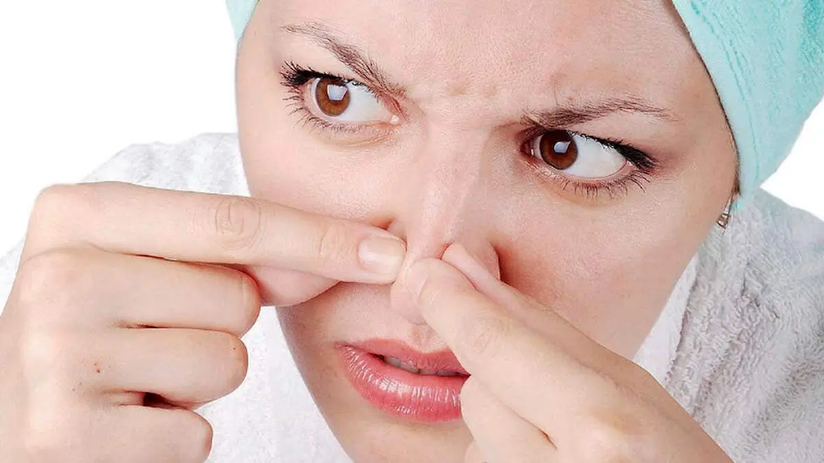 تکنیک های برای نابودی آکنه بینی