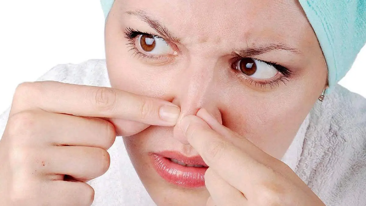 تکنیک های برای نابودی آکنه بینی