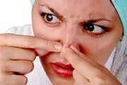 تکنیک های برای نابودی آکنه بینی