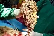 گشنگی این زن را را فقط خوردن طلا و جواهرات برطرف می‌کند! عکس