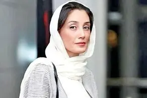 هدیه تهرانی با چهره باورنکردنی/ عکس