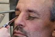 این مرد بلندترین مژه دنیا را دارد!+عکس