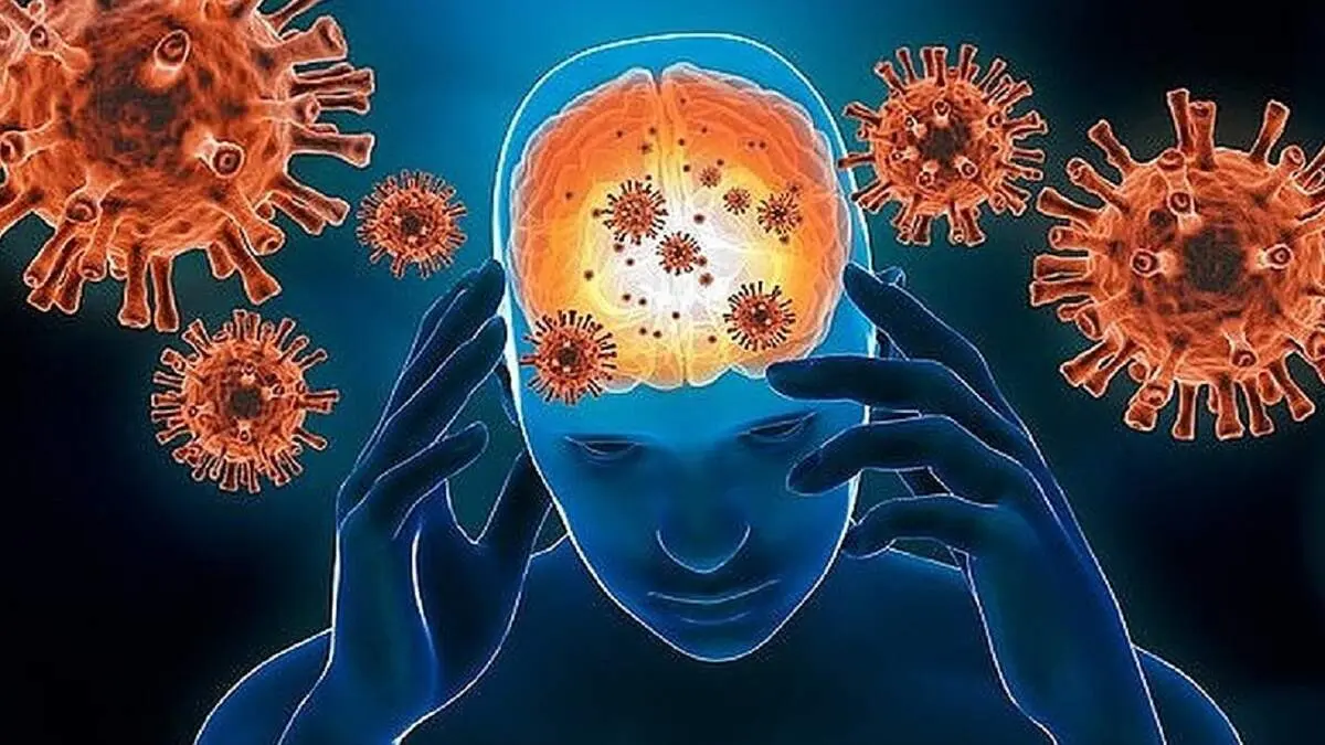 این دسته از بهبودیافتگان کرونایی به آلزایمر مبتلا می‌شوند!
