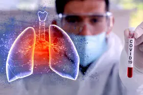 میزان درگیری ریه بیماران مبتلا به کرونا با این علائم قابل
 تشخیص است!
