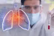 میزان درگیری ریه بیماران مبتلا به کرونا با این علائم قابل
 تشخیص است!