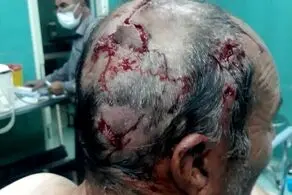حمله خرس وحشی به مرد روستایی+ عکس دلخراش