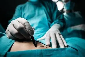 ۷ ترفند ساه برای خلاص شدن از شر چربی شکم