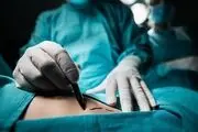 باورتان می شود این مرد 381 کیلویی حالا با وزن 89 کیلو این شکلی شده/ عکس