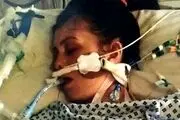 این موجود کوچولو زن جوان را به کما برد+عکس