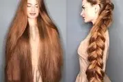 گیسو کمند شدن این دختر بعد یک دوره کچلی!
