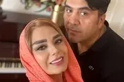 چهره نچرال صبا راد در ازداج اولش/ تصاویری بعد از عمل زیبایی با شوهر دومش مانی