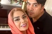 چهره نچرال صبا راد در ازداج اولش/ تصاویری بعد از عمل زیبایی با شوهر دومش مانی