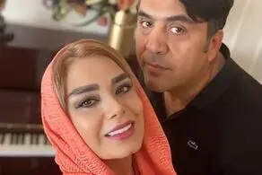 چهره نچرال صبا راد در ازداج اولش/ تصاویری بعد از عمل زیبایی با شوهر دومش مانی