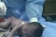 لحظه عجیب فرار نوزاد از شکم مادرش حین زایمان!+ عکس
