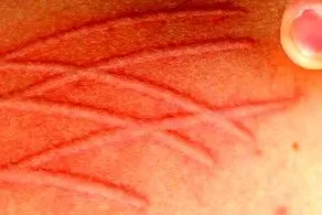 هیچکس نمی‌تواند به این دختر بسیار زیبا حتی دست بزند چه برسد به ازدواج!+عکس