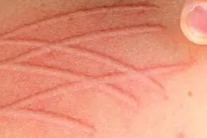هیچکس نمی‌تواند به این دختر بسیار زیبا حتی دست بزند چه برسد به ازدواج!+عکس