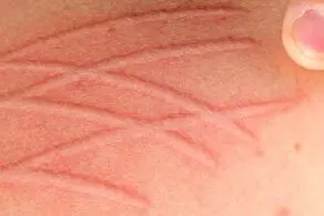 هیچکس نمی‌تواند به این دختر بسیار زیبا حتی دست بزند چه برسد به ازدواج!+عکس
