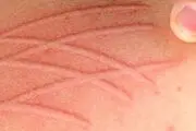 هیچکس نمی‌تواند به این دختر بسیار زیبا حتی دست بزند چه برسد به ازدواج!+عکس