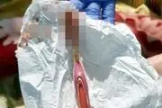 مرد احمق به جای آب دهانش، مسواک قورت داد!
