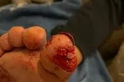 این سگ انگشت پای صاحبش را کند، اما او را نجات داد+عکس