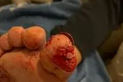 این سگ انگشت پای صاحبش را کند، اما او را نجات داد+عکس