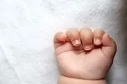 نوزاد عجیب 11 ماهه با وزن غیر قابل باور 28 کیلوگرم/ عکس


