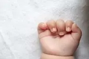 تولد نوزاد  عجیب الخلقه و ترسناک اندازه چند بند انگشت/ تصویر