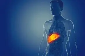 ۱۵ دستورالعمل ساده طب سنتی برای رهایی از کبد چرب
