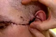 این زن صورتش را با مته نابود کرد! + عکس