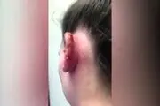 نتیجه دلخراش پیرسینگ دختر جوان+ عکس
