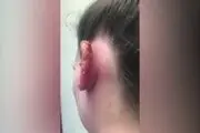 نتیجه دلخراش پیرسینگ دختر جوان+ عکس