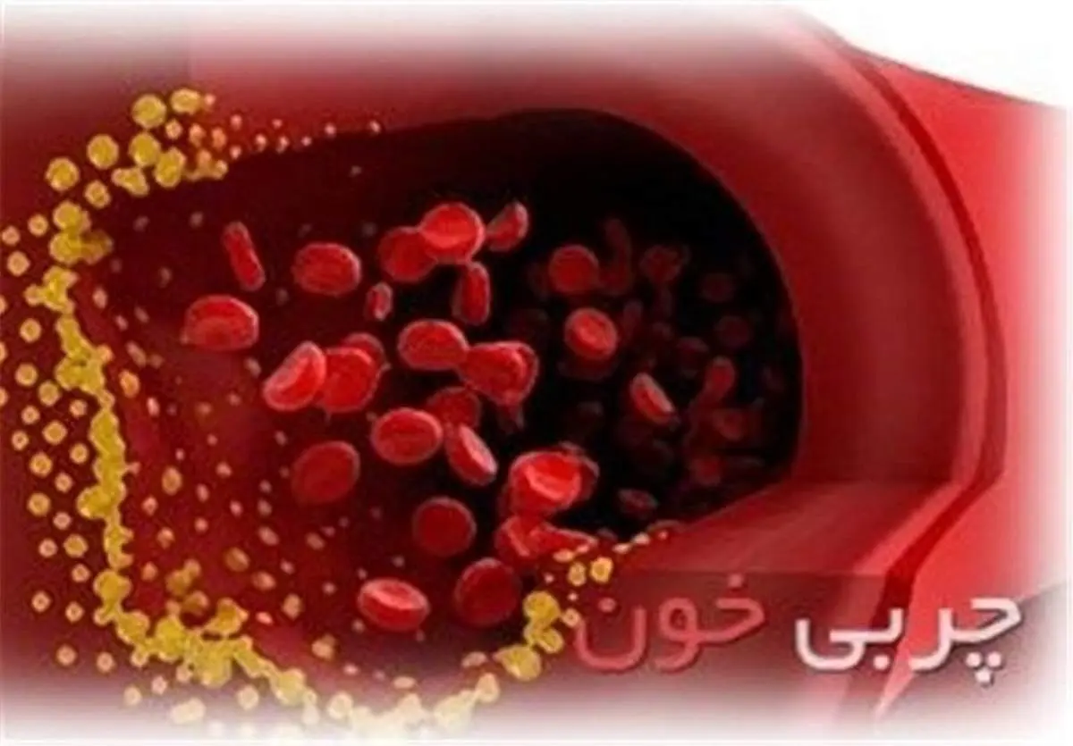 حقایقی درباره چربی خون که از آن بیاطلاعید!