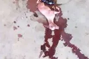 این زن بعد از 24 ماه بارداری یک "بز" زایید/ عکس+18