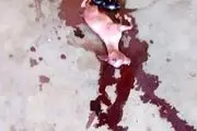 این زن بعد از 24 ماه بارداری یک "بز" زایید/ عکس+18