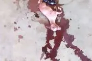 این زن بعد از 24 ماه بارداری یک "بز" زایید/ عکس+18
