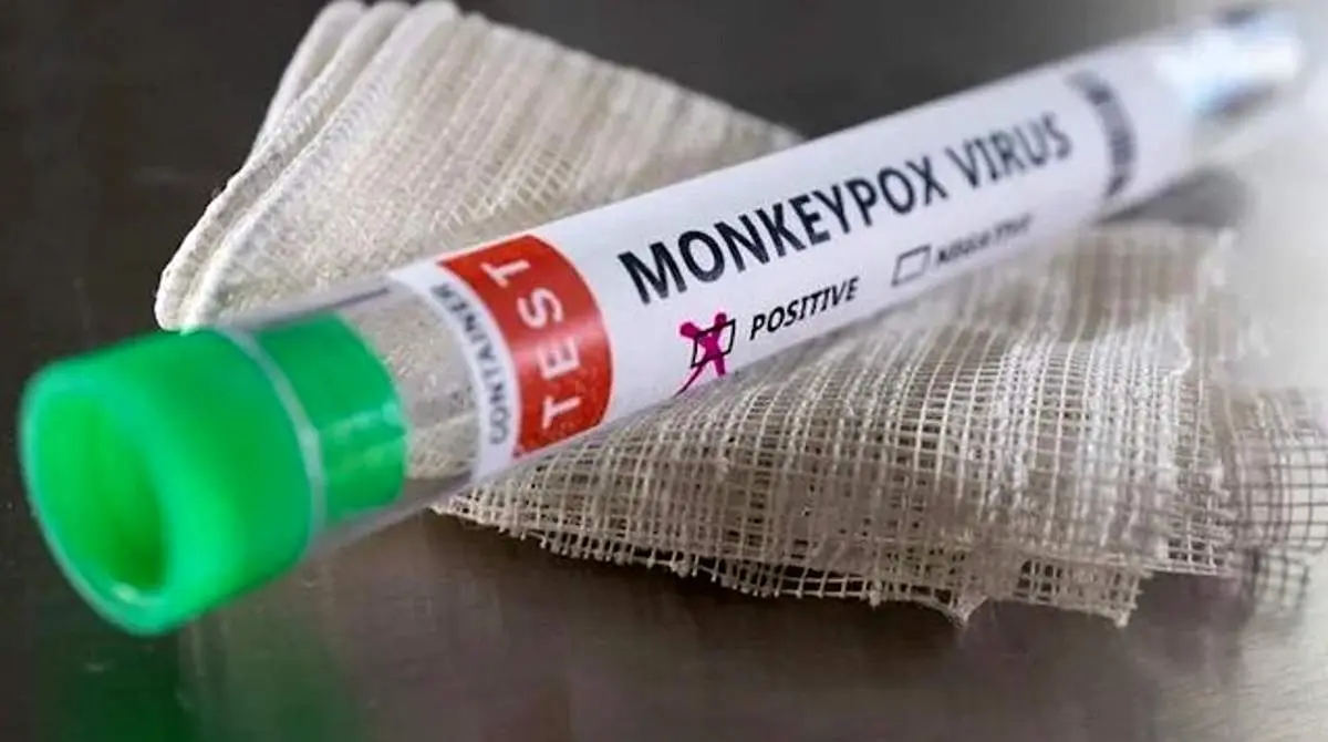 آبله میمونی در ایران فراگیر شد؟/ سفارش خرید واکسن دادند/ اولویت با کادر درمان