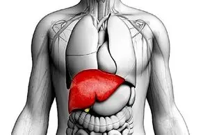 این علامت در پا‌ها نشانه کبد چرب است