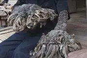 بیماری مرد درختی: علت و راه درمان