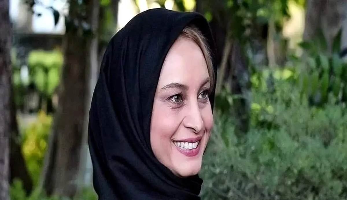 عکس جنجالی| تغییر چهره باورنکردنی خانم بازیگر بعد از طلاق از همسر سیاستمدارش!