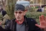 تجمع مقابل نهاد ریاست جمهوری به خشونت کشیده شد/ عکس از سر و صورت خونین مردم! + عکس