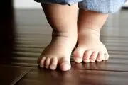  دختر 27 ساله به دلیل سکته مغزی مانند یک کودک شد + عکس

