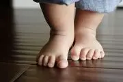  دختر 27 ساله به دلیل سکته مغزی مانند یک کودک شد + عکس

