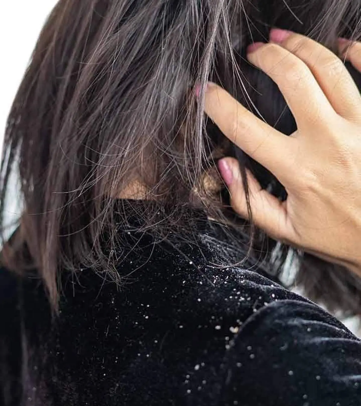 رفع خارش پوست سر این روشهای آسان