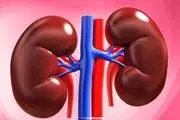 شاید باورتان نشود، این سنگ با این شکل و شمایل از کلیه یک بیمار خارج شده/ عکس

