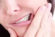 کشف جدیدترین عارضه ویروس کرونا